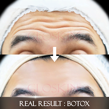 Hollywood Face Sculpting