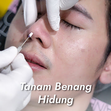 Tanam benang hidung