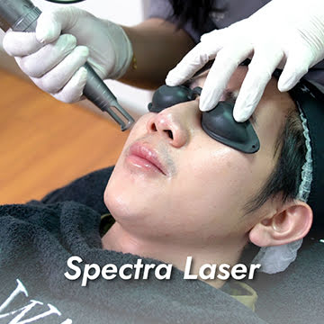 Spectra Laser
