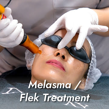 Melasma / Flek Treatment