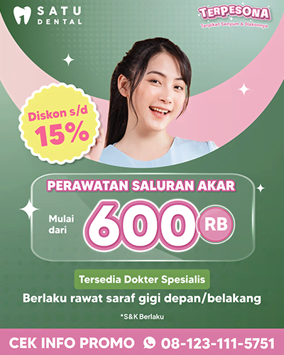 Promo Perawatan Saluran Akar S/d 15%