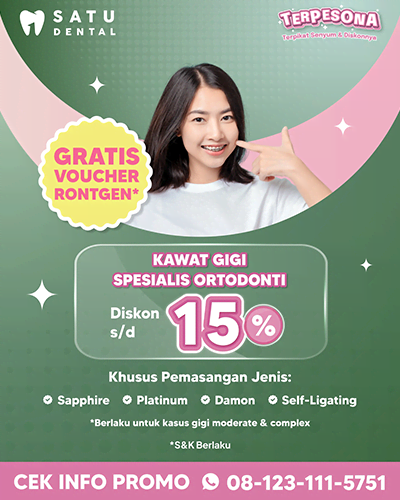 Promo Kawat Gigi Spesialis Ortodonti S/d 15%