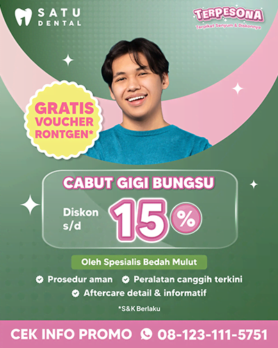 Promo Cabut Gigi Bungsu 15%