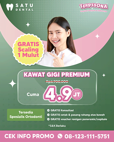 Promo Kawat Gigi Premium 4.9jt